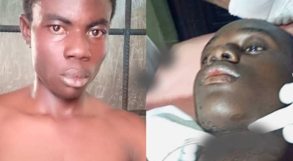 Police detain man for slitting friend’s throat in Kogi